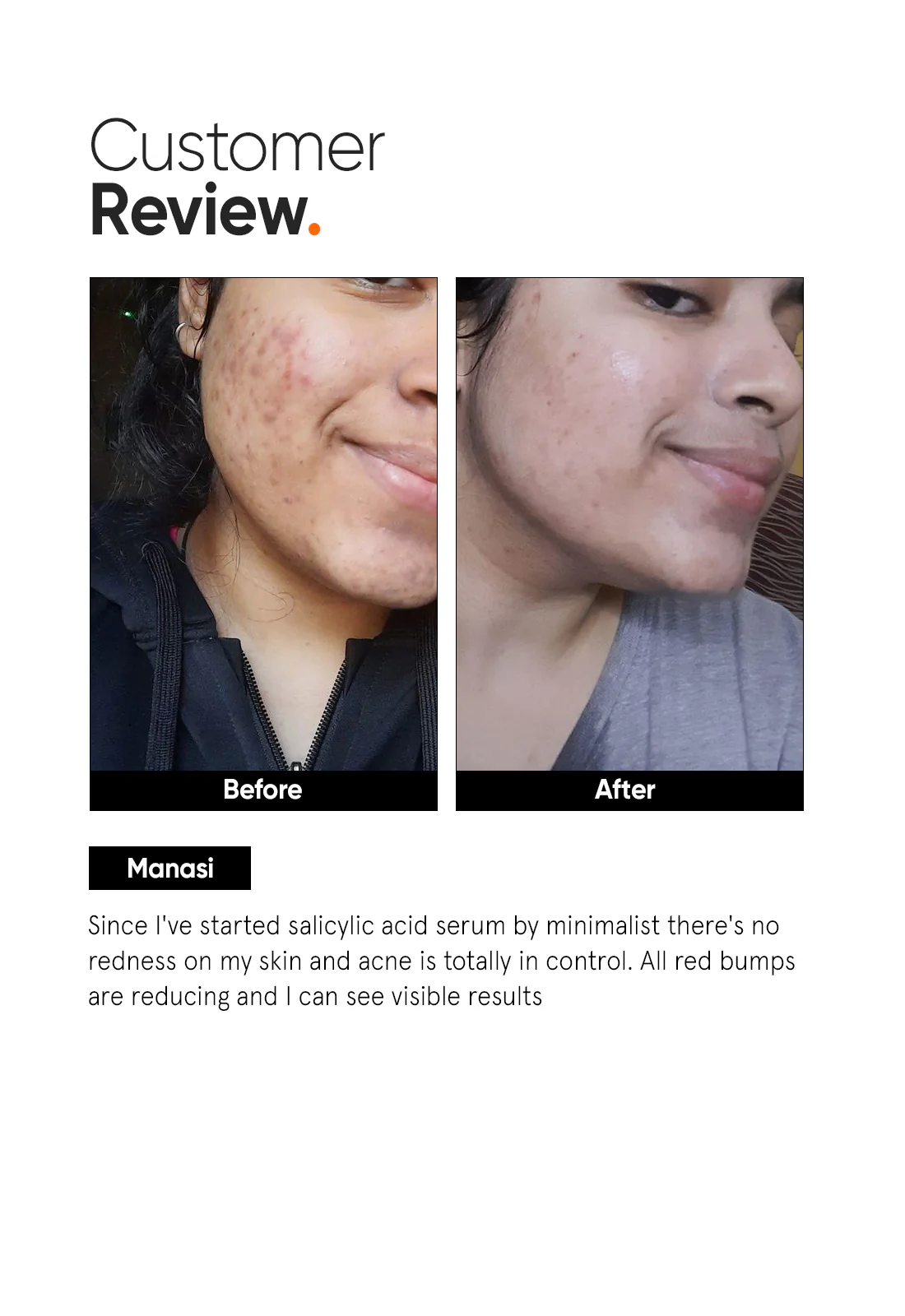 Salicylic Acid 2% Face Serum - Image 5